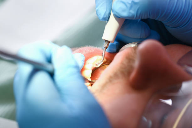 Best Broken or Cracked Tooth Emergency Dentist in Thompson Falls, MT