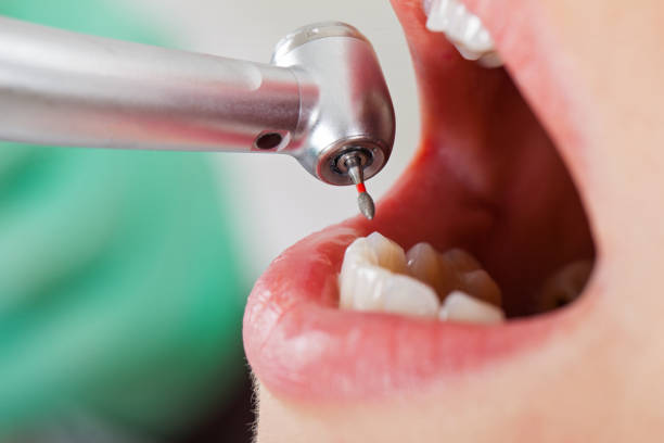 Best Orthodontic Emergency Dentist in Thompson Falls, MT